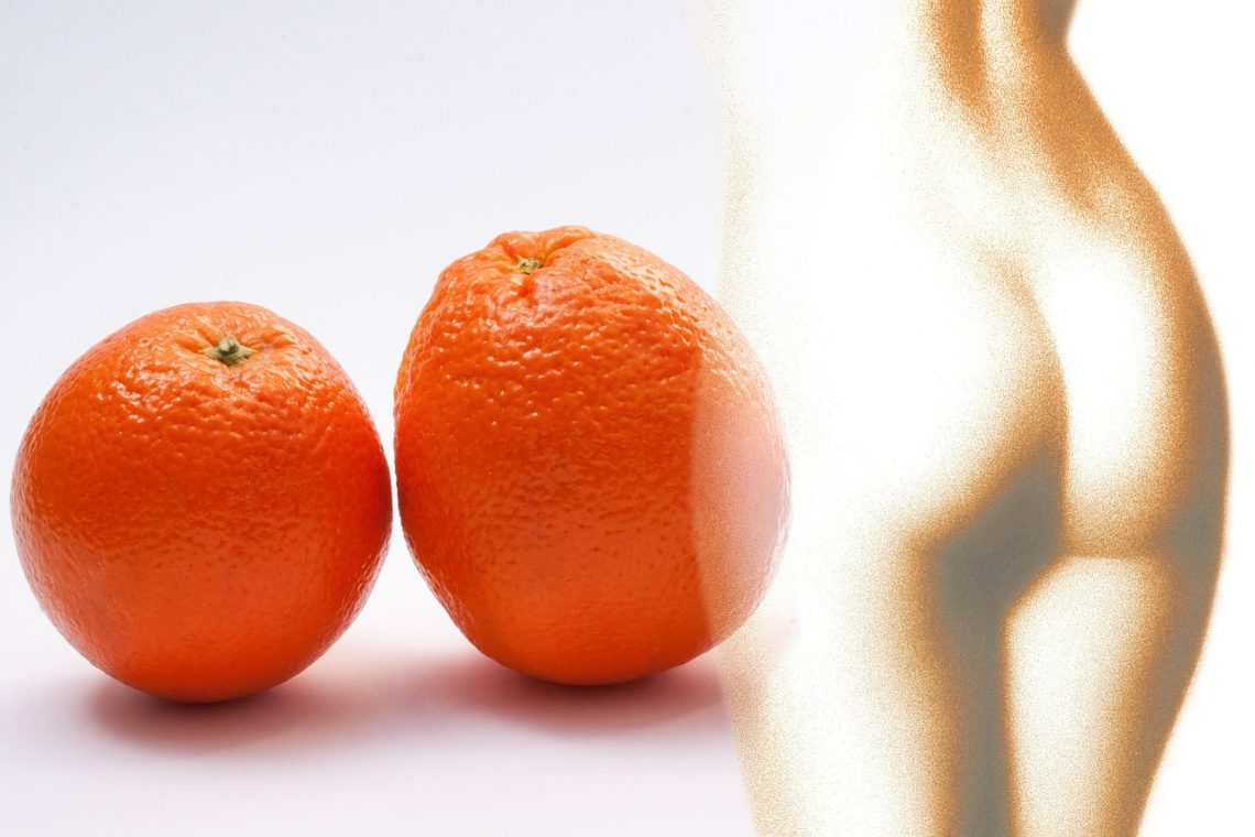 skórka pomarańczowa, cellulit