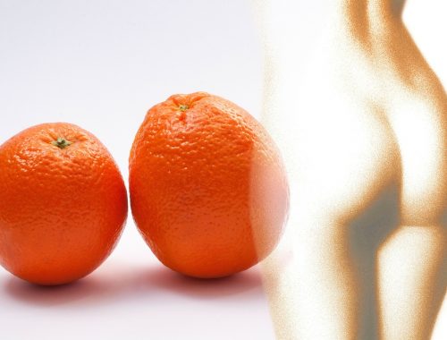 skórka pomarańczowa, cellulit